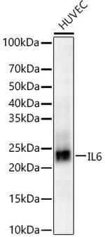 IL-6 Antibody in Western Blot (WB)