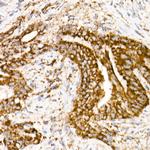 NDUFS1 Antibody in Immunohistochemistry (Paraffin) (IHC (P))