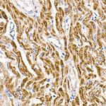 NDUFS1 Antibody in Immunohistochemistry (Paraffin) (IHC (P))