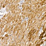 NDUFS1 Antibody in Immunohistochemistry (Paraffin) (IHC (P))