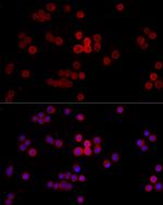 MYH14 Antibody in Immunocytochemistry (ICC/IF)