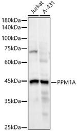 PPM1A Antibody in Western Blot (WB)