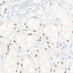 HNF1A Antibody in Immunohistochemistry (Paraffin) (IHC (P))