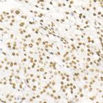 DNA Ligase III Antibody in Immunohistochemistry (Paraffin) (IHC (P))