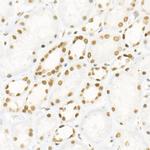 DNA Ligase III Antibody in Immunohistochemistry (Paraffin) (IHC (P))