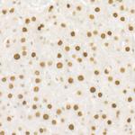 DNA Ligase III Antibody in Immunohistochemistry (Paraffin) (IHC (P))