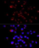 NF-H Antibody in Immunocytochemistry (ICC/IF)