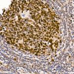 DNMT1 Antibody in Immunohistochemistry (Paraffin) (IHC (P))