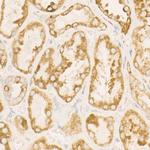 SDHC Antibody in Immunohistochemistry (Paraffin) (IHC (P))