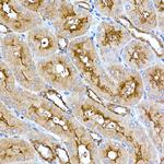 Folate Receptor alpha Antibody in Immunohistochemistry (Paraffin) (IHC (P))