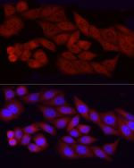 FGF2 Antibody in Immunocytochemistry (ICC/IF)