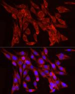 FGF2 Antibody in Immunocytochemistry (ICC/IF)