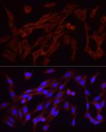 FGF2 Antibody in Immunocytochemistry (ICC/IF)