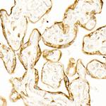 STIM1 Antibody in Immunohistochemistry (Paraffin) (IHC (P))