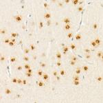 RNF8 Antibody in Immunohistochemistry (Paraffin) (IHC (P))