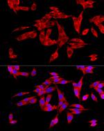 UGT1A1 Antibody in Immunocytochemistry (ICC/IF)