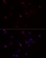 MMP3 Antibody in Immunocytochemistry (ICC/IF)