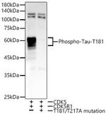 Phospho-Tau (Thr181) Antibody in Western Blot (WB)