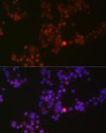 Phospho-p38 MAPK alpha (Tyr182) Antibody in Immunocytochemistry (ICC/IF)