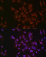 Phospho-p38 MAPK alpha (Tyr182) Antibody in Immunocytochemistry (ICC/IF)