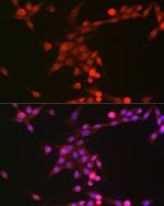 Phospho-p38 MAPK alpha (Tyr182) Antibody in Immunocytochemistry (ICC/IF)