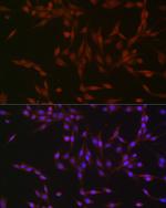 Phospho-p38 MAPK alpha (Tyr182) Antibody in Immunocytochemistry (ICC/IF)