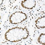 Phospho-p38 MAPK alpha (Tyr182) Antibody in Immunohistochemistry (Paraffin) (IHC (P))