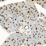 Phospho-p38 MAPK alpha (Tyr182) Antibody in Immunohistochemistry (Paraffin) (IHC (P))