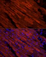 Cardiac Troponin I Antibody in Immunocytochemistry (ICC/IF)