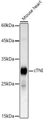 Cardiac Troponin I Antibody in Western Blot (WB)