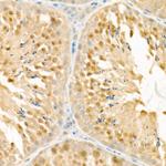 PSMC4 Antibody in Immunohistochemistry (Paraffin) (IHC (P))