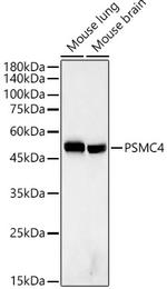 PSMC4 Antibody in Western Blot (WB)