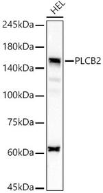 PLCB2 Antibody in Western Blot (WB)