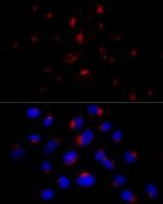 BST-2 Antibody in Immunocytochemistry (ICC/IF)