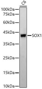 SOX1 Antibody in Western Blot (WB)