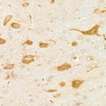 DARPP-32 Antibody in Immunohistochemistry (Paraffin) (IHC (P))