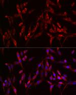 S100A10 Antibody in Immunohistochemistry (Paraffin) (IHC (P))