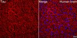 Tau Antibody in Immunocytochemistry (ICC/IF)