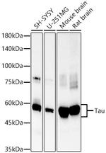 Tau Antibody in Western Blot (WB)