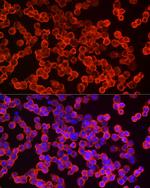 eIF4A1 Antibody in Immunocytochemistry (ICC/IF)