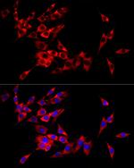 eIF4A1 Antibody in Immunocytochemistry (ICC/IF)