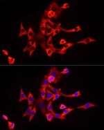 eIF4A1 Antibody in Immunocytochemistry (ICC/IF)