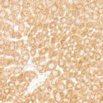 eIF4A1 Antibody in Immunohistochemistry (Paraffin) (IHC (P))