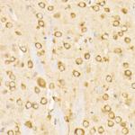 GRP78 Antibody in Immunohistochemistry (Paraffin) (IHC (P))