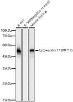 Cytokeratin 17 Antibody in Western Blot (WB)