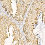 EEF1A1 Antibody in Immunohistochemistry (Paraffin) (IHC (P))