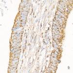 BAK Antibody in Immunohistochemistry (Paraffin) (IHC (P))