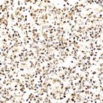 Phospho-AKT Pan (Thr450, Thr451, Thr447) Antibody in Immunohistochemistry (Paraffin) (IHC (P))