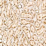 Phospho-AKT Pan (Thr450, Thr451, Thr447) Antibody in Immunohistochemistry (Paraffin) (IHC (P))