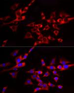 EIF4A1/EIF4A2/EIF4A3 Antibody in Immunocytochemistry (ICC/IF)